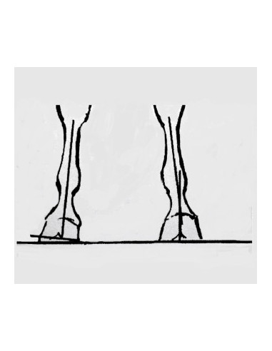 TDL - Outil d'évaluation pour le parage