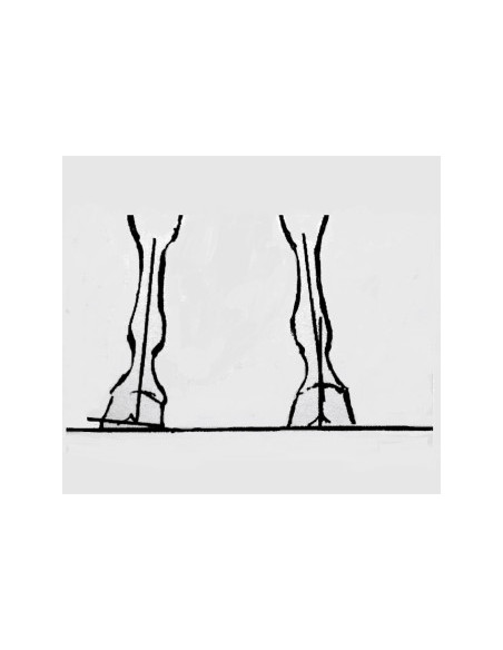 TDL - Outil d'évaluation pour le parage