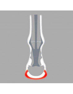 ACR - 100 Wide-Webbed Shoe 2