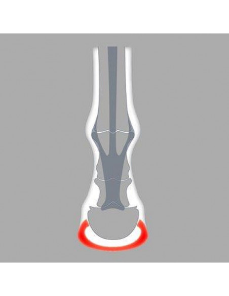 ACR - 100 Wide-Webbed Shoe ACR - 100 Wide-Webbed Shoe