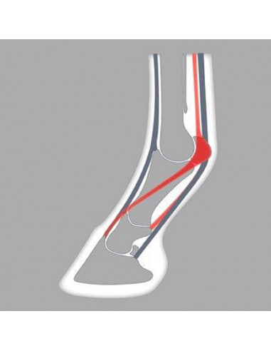 ACR - 110 Suspensory Shoe