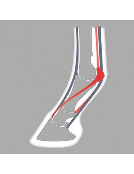 ACR - 110 Suspensory Shoe ACR - 110 Suspensory Shoe