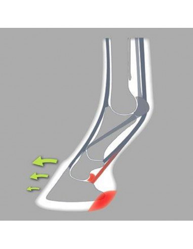 ACR - 200 Onion Shoe