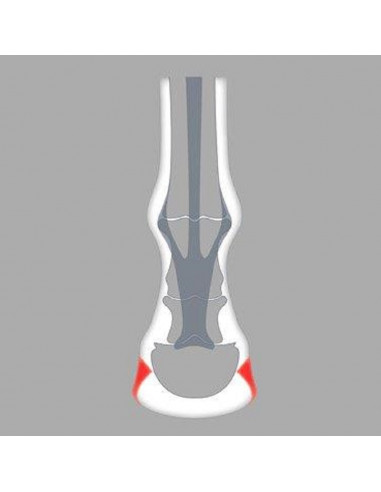 ACR - 200 Onion Shoe