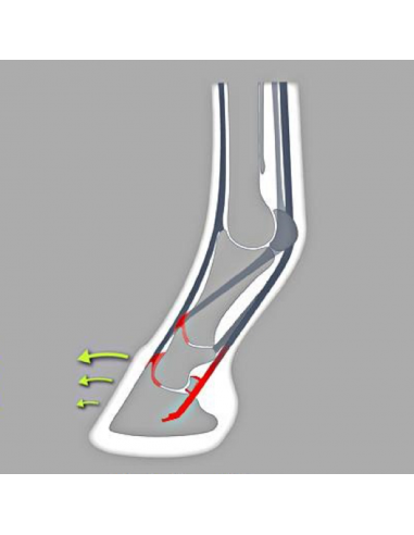 ACR - 335 Wedge Balance