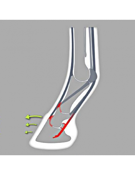 Fers à cheval aluminium - ACR 335 - Fer wedge balance Fers à cheval aluminium - ACR 335 - Fer wedge balance