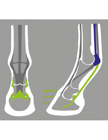 ACR - 340 Sport + Shoe