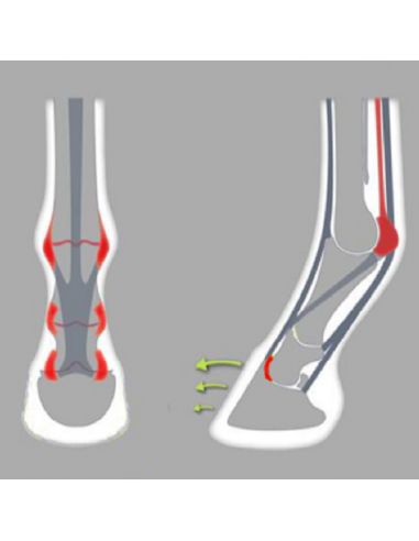 ACR - 350 Asymmetric Shoe