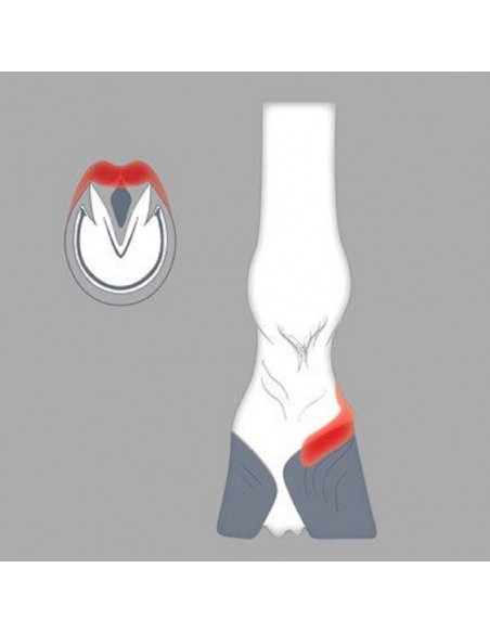 ACR - 400 Straight Bar Shoe ACR - 400 Straight Bar Shoe