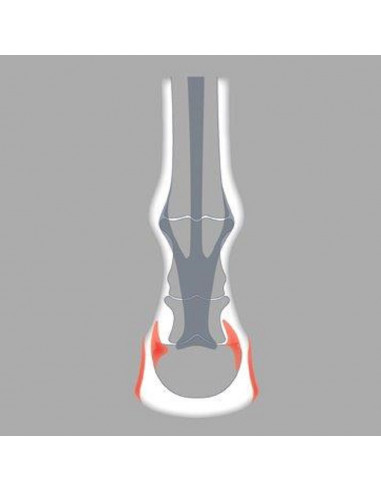 ACR - 400 Straight Bar Shoe