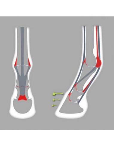 ACR - 700 Center Support Shoe
