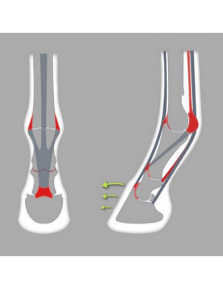 ACR - 700 Center Support Shoe ACR - 700 Center Support Shoe